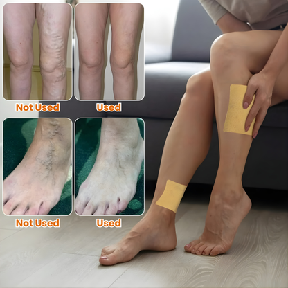VeinEase™ Varicose Herbal Relief Patches